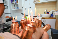 تخلصوا من آلامكم بالحجامة مع الاختصاصي موسى أبو سريس